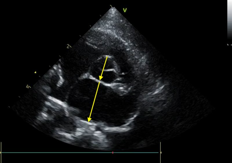 LA:Ao measurement in cats