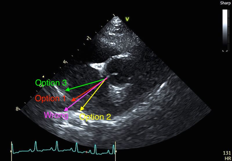 Options to measure around vein