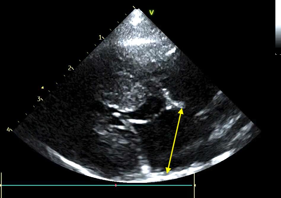 LAD measurement in cats