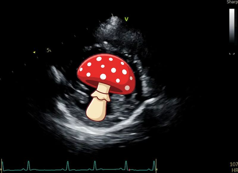 Mushroom view with mushroom