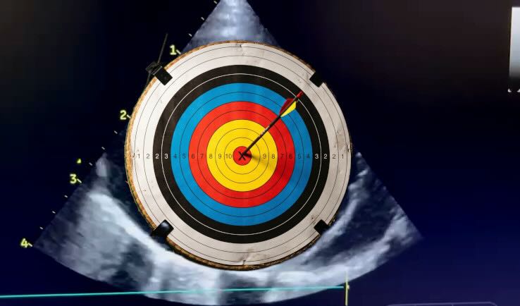 Bulls eye
