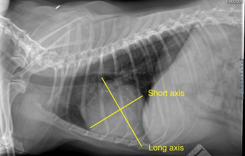 chest rad showing axes