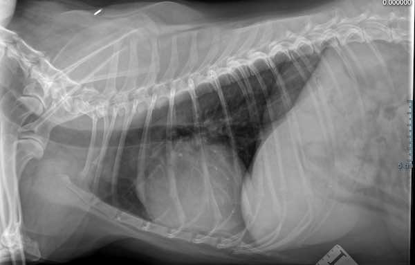 Chest Radiograph
