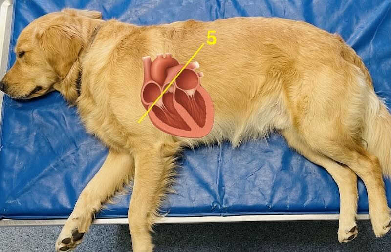 Pulmonic trunk plane
