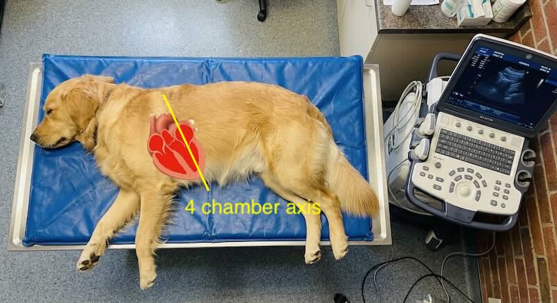 Axis for 4 chamber view